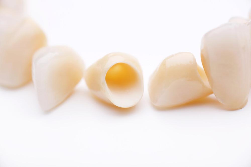 dental crowns in troy ny