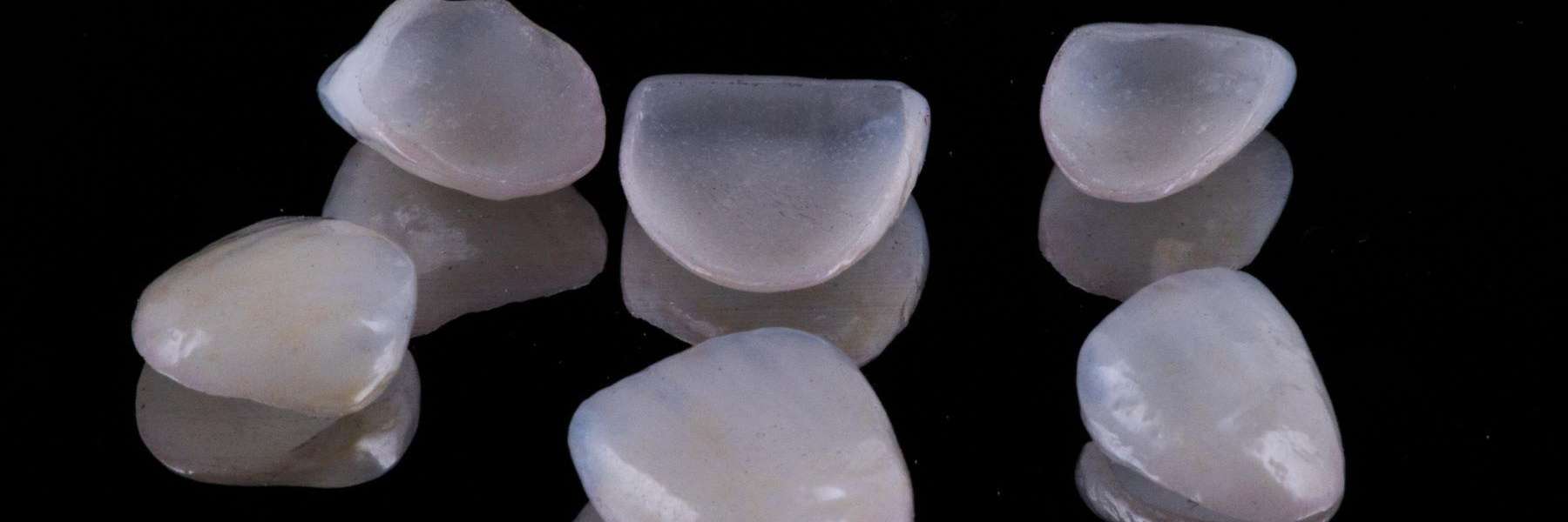 veneers