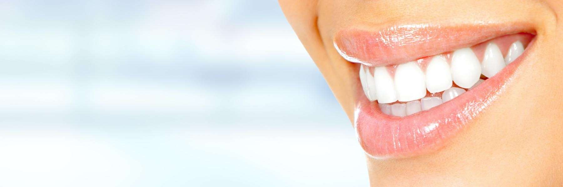 close up of patient's smile