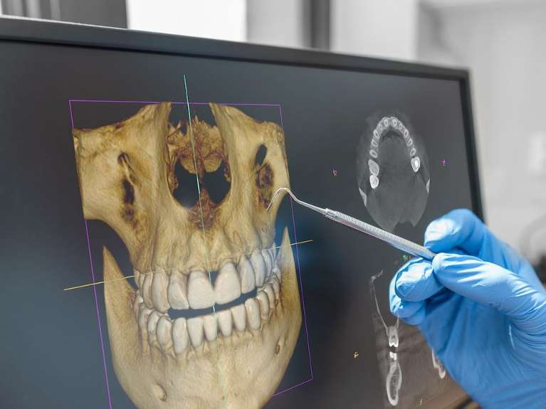 CBCT 3-D Imaging in troy ny