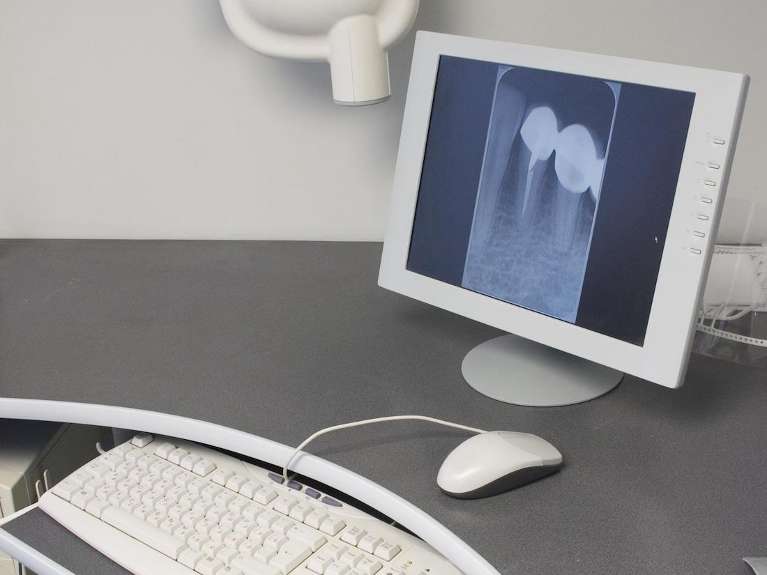 digital x-rays used in troy ny