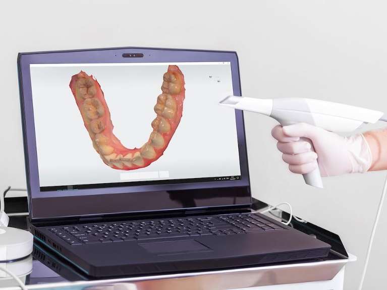 Intraoral Scanner in troy ny